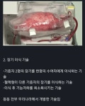 의외로 한국이 세계1위 기술을 갖고 있는 의료 분야 - 악플달면 쩌리쩌려버려 - ＊여성시대＊ 차분한 20대들의 알흠다운 공간 의외로 한국이... 
