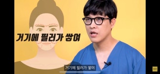 ‘필러 성형’ 절대 하면 안되는 이유 (흐린눈 하지말고 들어와) - 악플달면 쩌리쩌려버려 - ＊여성시대＊ 차분한 20대들의 알흠다운 공간 ‘필러... 