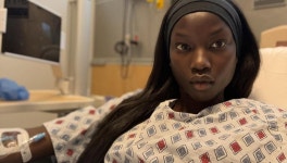 선천적 폐 결함으로 수술 받은 탑모델 아녹야이 - 악플달면... 차분한 20대들의 알흠다운 공간 선천적 폐 결함으로 수술 받은 탑모델 아녹야이