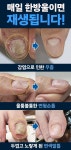 바르는 중인데 많이 치료 되었어요. - 주방생활용품(이쁘지후) - 부치미네참살이 30년 넘은 발톱무좀 4개월째 바르는 중인데 많이 치료 되었어요.