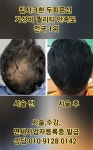 제이도트스칼프SMP두미각 | 칩시크한 두피문신의 대명사 두미각 가성비 퀄리티 만족도 전국 1위 - 동영상과 사진 및 가격 - 사)SMP두미각,합법면세교육기관 칩시크한...