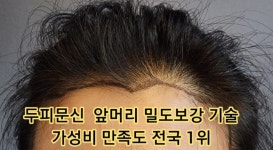 스켈프SMP두미각 | SMP 두미각은 기술이 다릅니다 시간과 돈을 절약하세요 ^^ - 동영상과 사진 및 가격 - 사)SMP두미각,합법면세교육기관 SMP 두미각은 기술이...