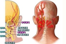 경추(목뼈)신경 8쌍. 후두(뒤통수)신경통 - 자료 게시판 - mind control TI 경추(목뼈)신경 8쌍. 후두(뒤통수)신경통