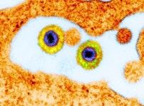 헤르페스 구내염 빨리 낫는 법 - news - Medicinal Research 헤르페스 구내염 빨리 낫는 법