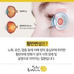 건강정보ㅡ주요실명 원인 ㅡ노인성 황반 변성 Q&Aㅡ 평소 눈이 좋았는데 최근 갑자기 ㅡ사물이 찌그러져 보여 ㅡ인근 안과에 가받서 진료를... 