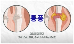 건강정보 ㅡ 통증 통풍 ㅡ 바람만 스쳐 지나가도 ㅡ 극심한 통증 통풍 ㅡ통풍이란 관절이 갑자기 ㅡ 벌겋게부어오르면서 심한 통증이 생 - 청솔... 