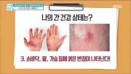 건강 정보 ㅡ간 건강 자가 진단법ㅡ간은 우리 몸에서 ㅡ 가장 큰 내장 기관으로 ㅡ영양분의 대사와 저장ㅡ 면역조절 등 신체기능을ㅡ유지하는... 