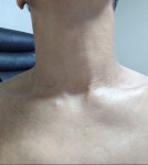 퇴원했어요. - 자유게시판 - 아토피 학교 퇴원했어요.