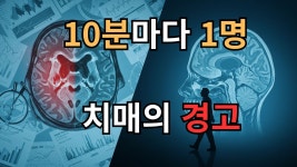 10분마다 1명, 치매의 경고… 지금 시작하면 늦지 않았습니다... 한류열풍 사랑 10분마다 1명, 치매의 경고… 지금 시작하면 늦지 않았습니다