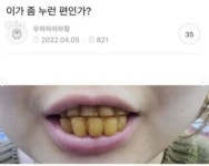 이가 좀 누런편인가?.jpg - 유쾌방 - 엽기 혹은 진실 (세상 모든 즐거움이 모이는 곳) 이가 좀 누런편인가?.jpg