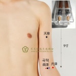 곡택혈 - ├……제니센 처방전 - 건강한 삶을 열어가는 힐링라이프 건강한 삶을 열어가는 힐링라이프