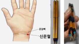 턱관절 장애 제니센 치료방법 & 특수자석 자가치료 상담 - ▣ 특수자석 자가치료 상담 - 힐링 라이프 힐링 라이프