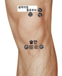 무릎에 물이 차면 꼭 빼야 할까요 ? 무릎관절 물이차는 증상 치유 사례 - ▣ 자석 복합요법 자가치료 - 건강한 삶을 열어가는 힐링라이프 건강한... 