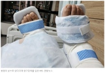 왼발 수술인데 오른발 절단... - 엽기사진실 - 이종격투기 왼발 수술인데 오른발 절단...