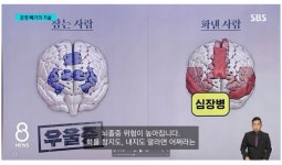 화 참는 사람 뇌 VS 화낸 사람 뇌 비교 - 엽기사진실 - 이종격투기 화 참는 사람 뇌 VS 화낸 사람 뇌 비교
