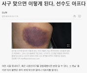 프로야구 선수들이 공 맞으면 피멍이 드는 이유 - 엽기사진실 - 이종격투기 프로야구 선수들이 공 맞으면 피멍이 드는 이유