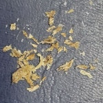 부산 한미보청기난청센타 보청기고객의 외이도에서 나온 귀지 - 보청기 및 외이도 청소사진과 보청기,귀,난청 자료 - 맑고 좋은소리/부산... 