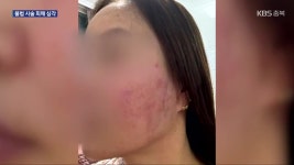 “싸고 효과 좋아” 불법 피부 시술…후유증 심각 - kakaoTV “싸고 효과 좋아” 불법 피부 시술…후유증 심각