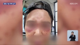 “싸고 효과 좋아” 불법 피부 시술…후유증 심각 - kakaoTV “싸고 효과 좋아” 불법 피부 시술…후유증 심각
