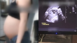 36주 임신중절 수술 병원장 태아 사산했고 시신은 화장했다 - kakaoTV 36주 임신중절 수술 병원장 태아 사산했고 시신은 화장했다