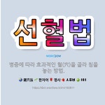 🌟선혈법: 병증에 따라 효과적인 혈(穴)을 골라 침을 놓는 방법. - 표준국어대사전