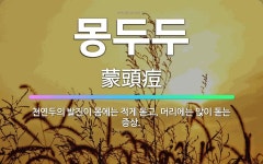 🌟몽두두: 천연두의 발진이 몸에는 적게 돋고, 머리에는 많이 돋는 증상. - 표준국어대사전