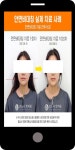 광고정보센터 MOBILE광고 :: 안면비대칭 실제 치료 사례