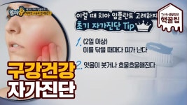 내 입속은 임플란트를 해야할까? *자가진단 방법*