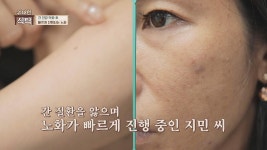 간 건강이 무너진 후.. 무려 7년이나 빠르게 진행된 노화 | JTBC 220820 방송 | ZUM TV