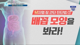 전신 건강 위협하는 M자형 장 배꼽 모양으로 진단하라 | ZUM TV