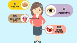 고혈압의 위험한 합병증 4가지! (황금 장바구니) | ZUM TV