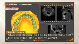 연희씨에게 온 기회! 최고의 임플란트 시술! | ZUM TV