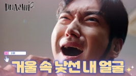 효과 직방 발모제✨슈퍼털✨ 구레나룻만 풍성~🧔 TV CHOSUN 240817 방송 | ZUM TV