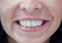 Smile Picture. Image: 1746972