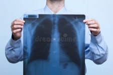 9,092 Chest Ray Stock Photos - Free & Royalty-Free Stock Photos from Dreamstime