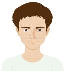 Zits Stock Illustrations – 32 Zits Stock Illustrations, Vectors & Clipart - Dreamstime