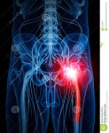 Painful sciatic nerve stock illustration. Illustration of body - 58776014