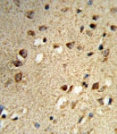 100 µg RIP140 Antibody 1 mg/ml from Thermo Fisher Scientific, Inc.