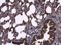 250 µg EphB1 Antibody from Thermo Fisher Scientific, Inc.