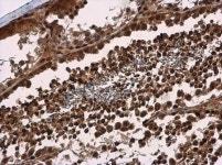 100 µL UPF1 Antibody 1 mg/ml from Thermo Fisher Scientific, Inc.