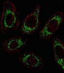 50 µg TCF2 Antibody 1 mg/ml from Thermo Fisher Scientific, Inc.