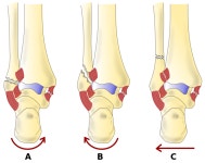 Danis–Weber classification