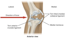 Knee