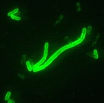 Plague (disease)