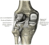 Microfracture surgery