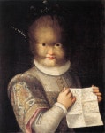 Hypertrichosis