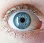 Eye color