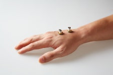 Moxibustion