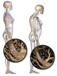Healthy eating habits/Answering Questions about Women, Healthy bones and Sources of Calcium
