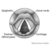 Laryngoscopy